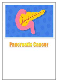 What Do Doctors Say About Pancreatic Cancer