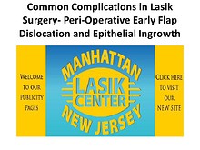 Common Complications in Lasik Surgery- Peri-Operative Early Flap Dislocation and Epithelial Ingrowth
