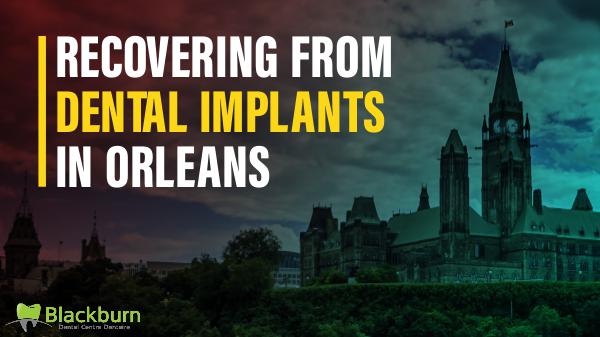 Recovering from Dental Implants in Orleans Dental Implants in Orleans