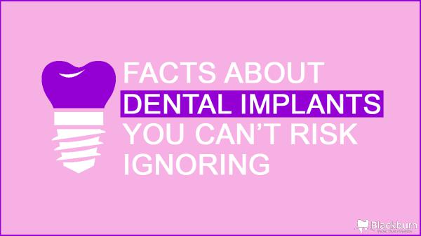 Facts About Dental Implants You Can’t Risk Ignoring Facts-About-Dental-Implants-You-Can’t-Risk-Ignorin