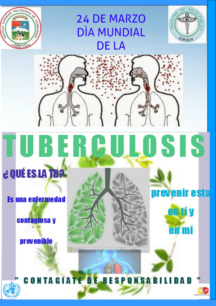 TUBERCULOSIS 1