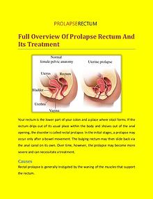 Prolapse Rectum Treatment