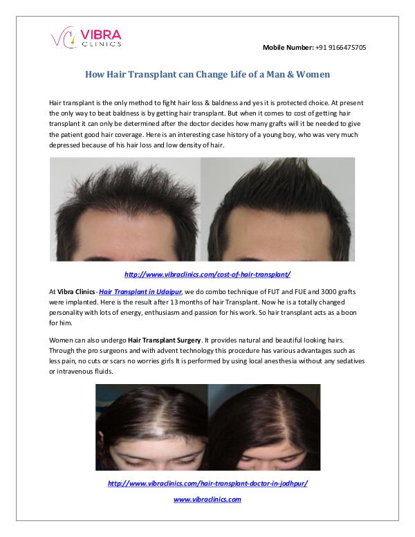 How Hair Transplant Can Change Life of a Man
