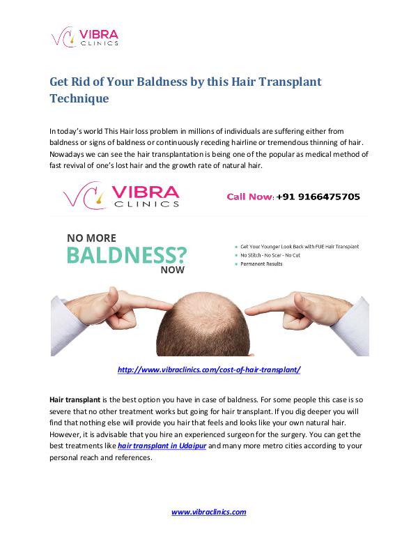 Get Rid of Your Baldness by This Hair Transplant Technique Get Rid of Your Baldness by this Hair Transplant T