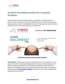 Get Rid of Your Baldness by This Hair Transplant Technique
