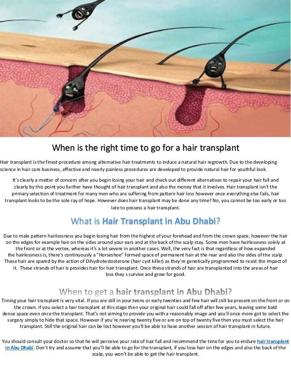 When is the right time to go for a hair transplant hair transplant in Abu Dhabi