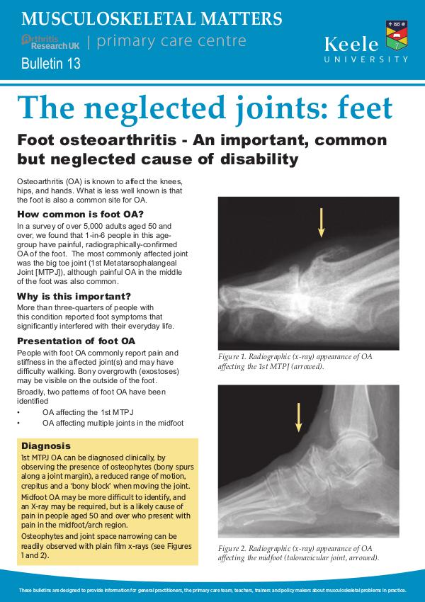 Musculoskeletal Matters 13: The neglected joints: feet