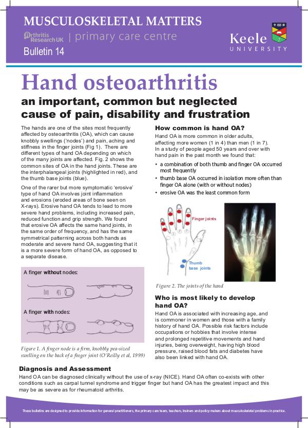 Musculoskeletal Matters 14: Hand Osteoarthritis