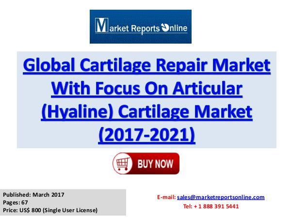 Cartilage Repair Market Analysis Global Forecast to 2017-2021 March 2017