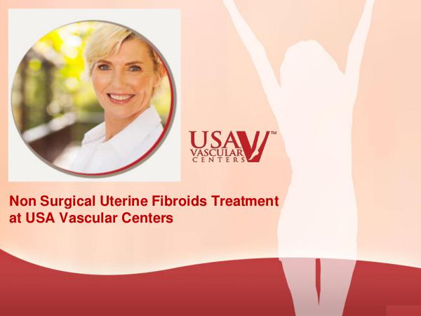 Non Surgical Uterine Fibroids Treatment Non Surgical Uterine Fibroids Treatment