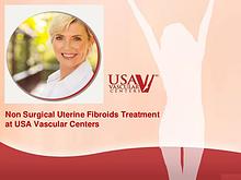 Non Surgical Uterine Fibroids Treatment