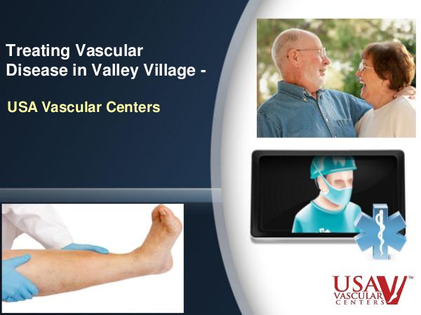 Treating Vascular Disease in Valley Village Vascular Disease in Valley Village