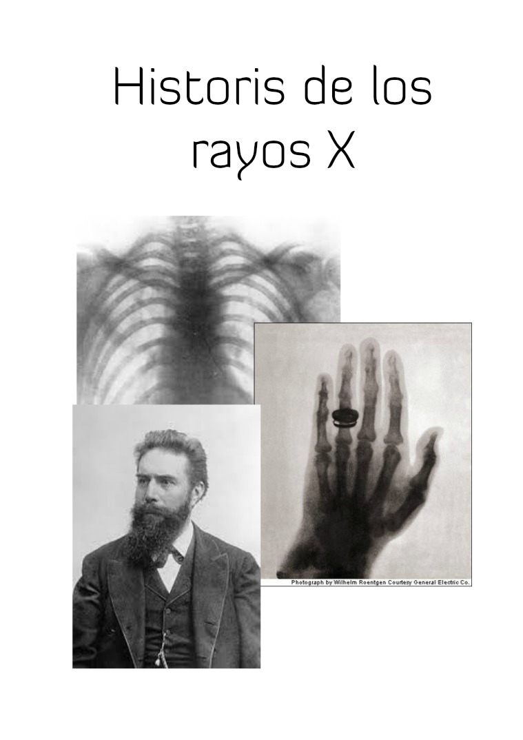 Historia de los Rayos X 1