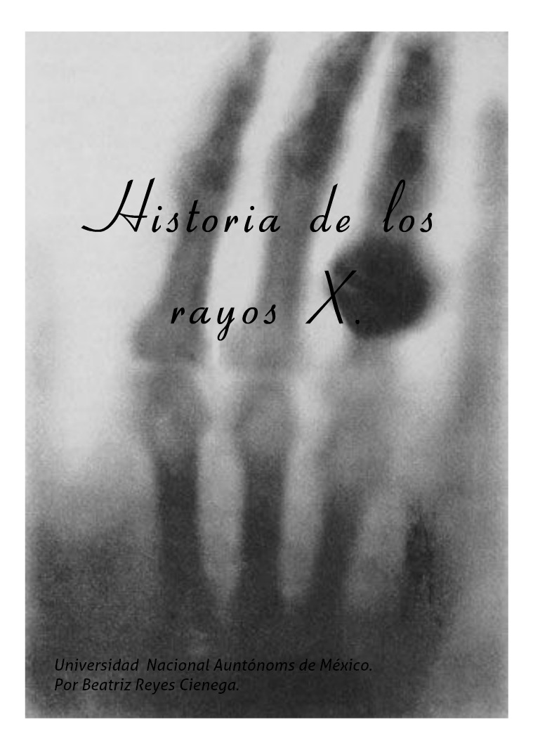 Historia de los rayos X 1