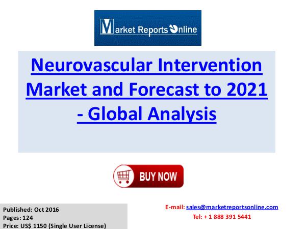 Neurovascular Intervention Industry Research Report Trends Forecast Neurovascular Intervention Market Forecast to 2021