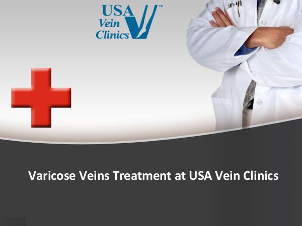 Varicose Veins Treatment at USA Vein Clinics Varicose Veins Treatment
