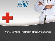 Varicose Veins Treatment at USA Vein Clinics