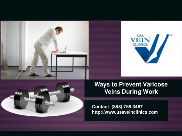 Ways to Prevent Varicose Veins During Work Prevent Varicose Veins During Work