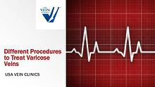 Varicose Veins Treatment Procedures - USA Vein Clinics
