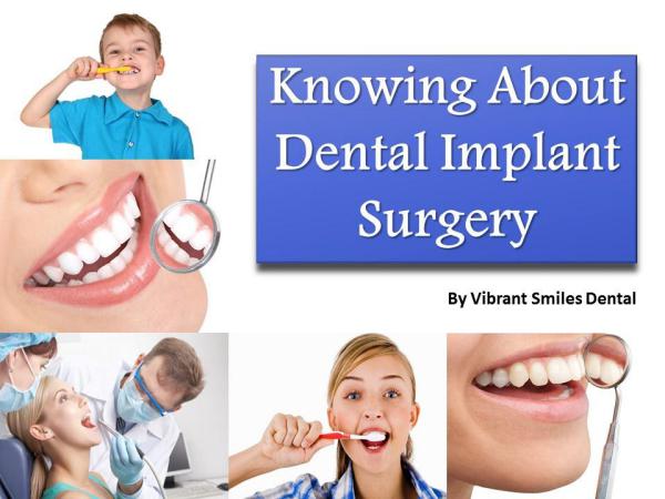 Knowing About Dental Implant Surgery Knowing About Dental Implant Surgery