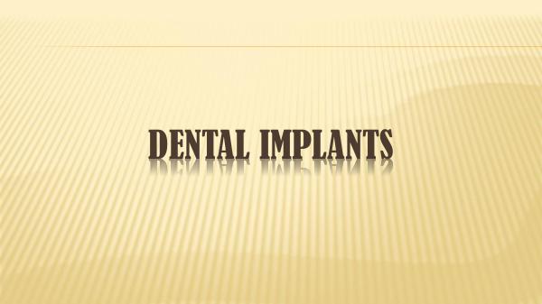 All You Need To Know About Dental Implants
