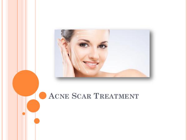 All About Acne Scar Treatment