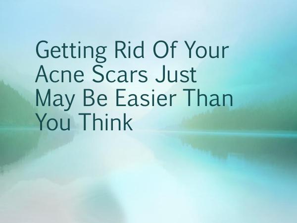 Getting Rid Of Your Acne Scars Just May Be Easier