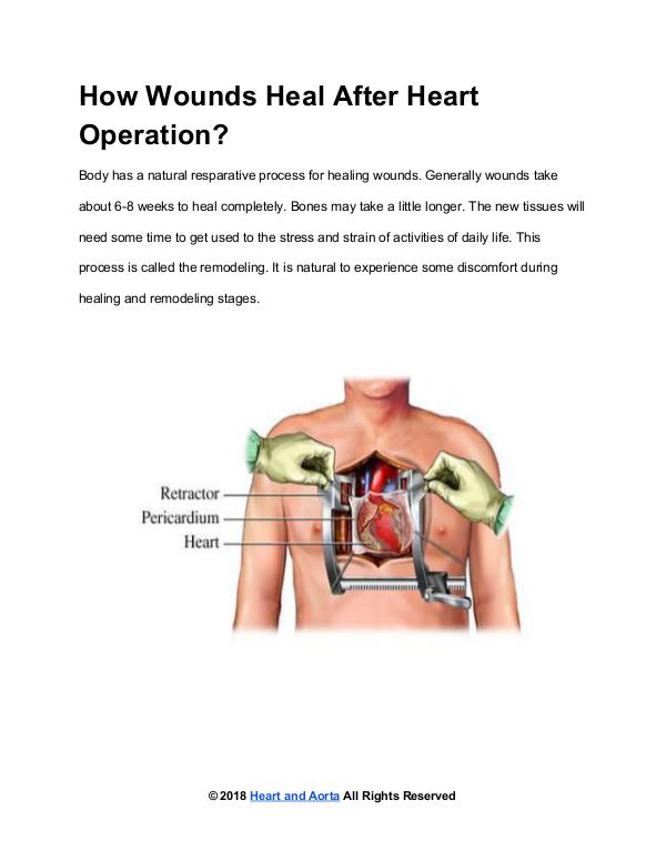 Heart and Aorta How Wounds Heal After Heart Operation?