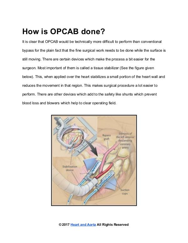 Heart and Aorta ﻿How is OPCAB done?