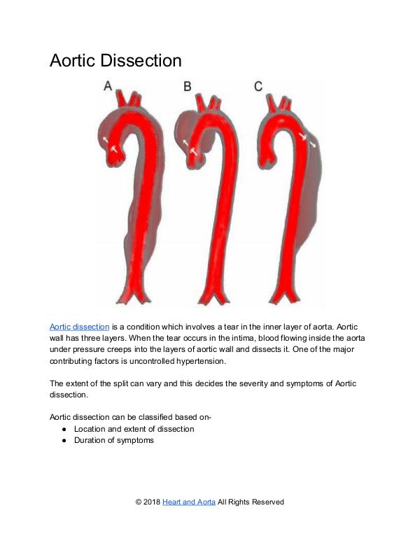 ﻿Aortic Dissection - An Overview