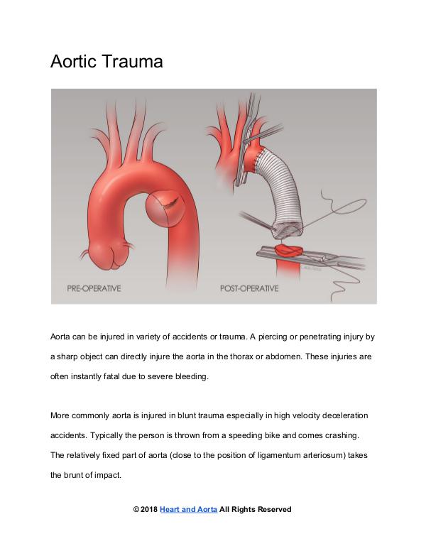Heart and Aorta ﻿Aortic Trauma