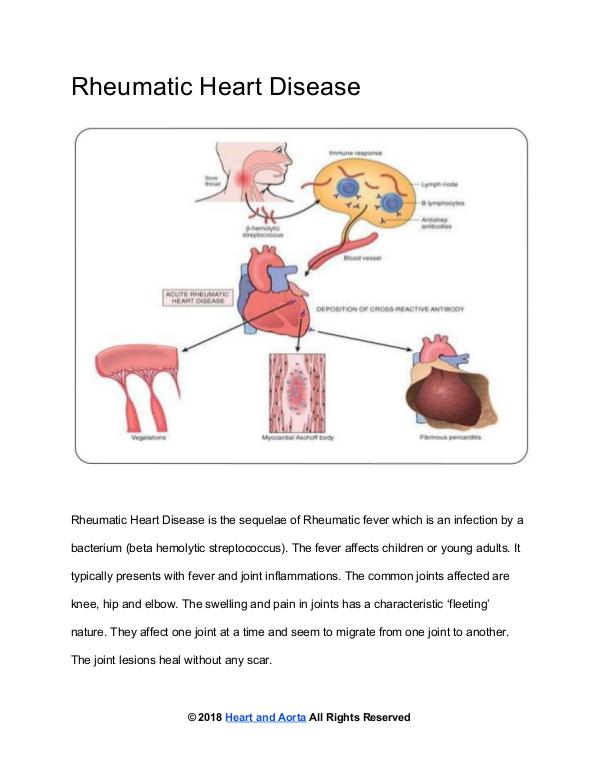 Heart and Aorta Rheumatic Valvular Disease