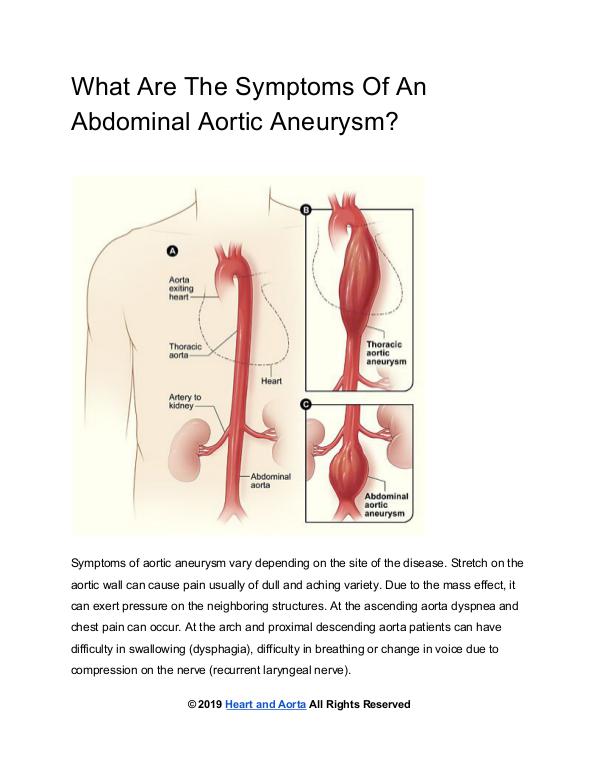 Abdominal Aortic Aneurysm Symptoms
