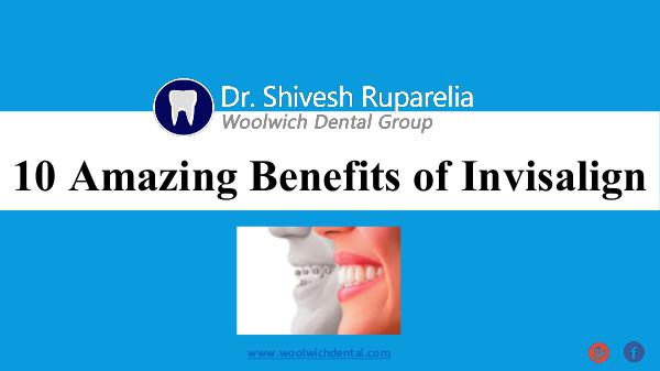 10 Amazing Benefits of Invisalign 10 Amazing Benefits of Invisalign