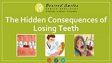 What are the Hidden Consequences of Losing Teeth?