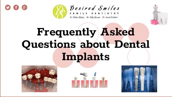 What are Some Frequently Asked Questions about Dental Implants Frequently Asked Questions about Dental Implants
