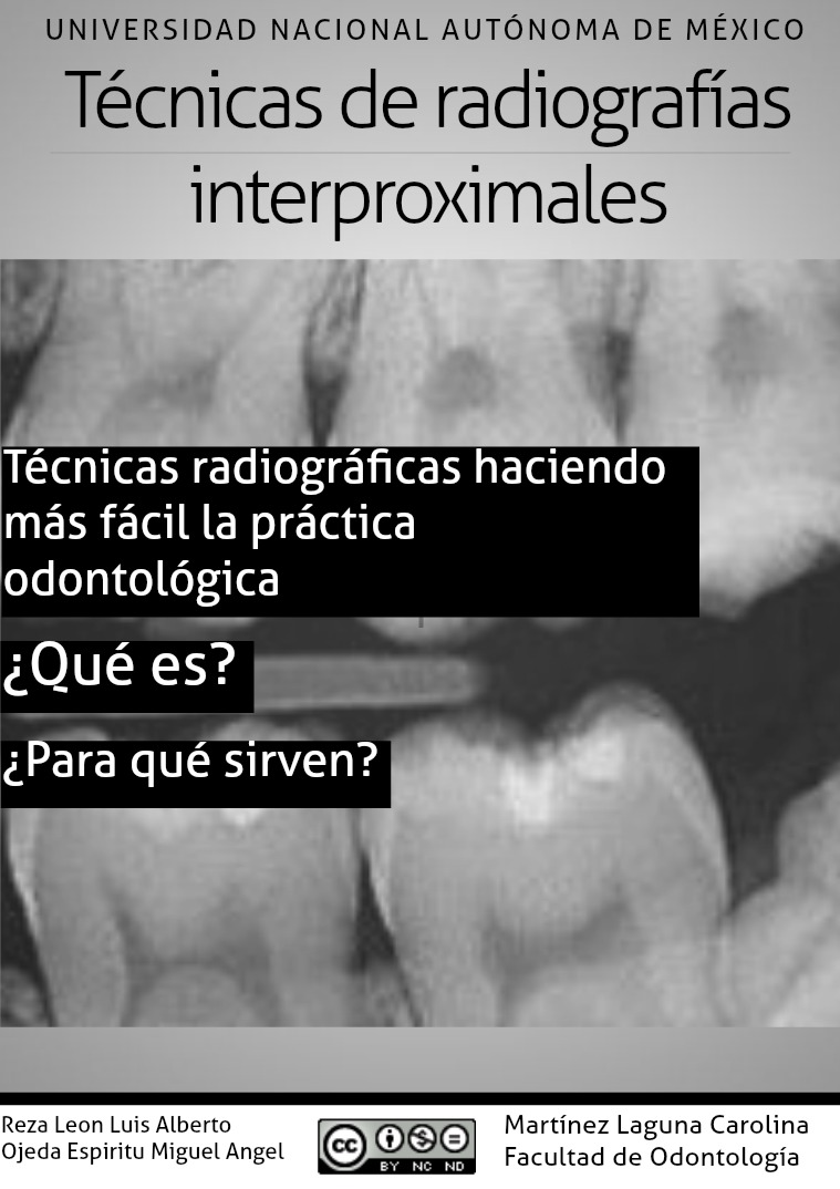 Radiografía interproximal 1