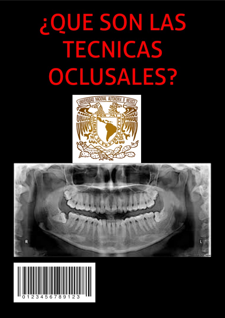 Técnicas Oclusales en la odontologia
