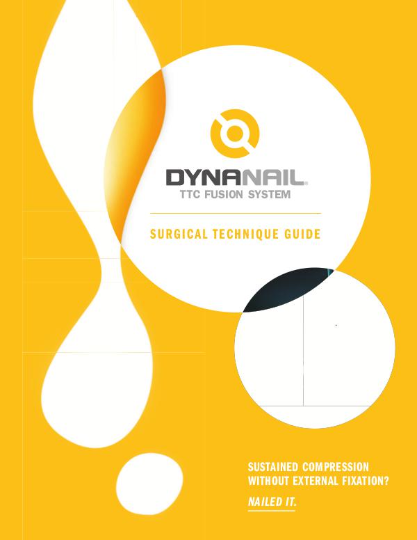 DynaNail® TTC Fusion System– Surgical Technique Guide DynaNail® TTC Fusion System– Surgical Technique Gu