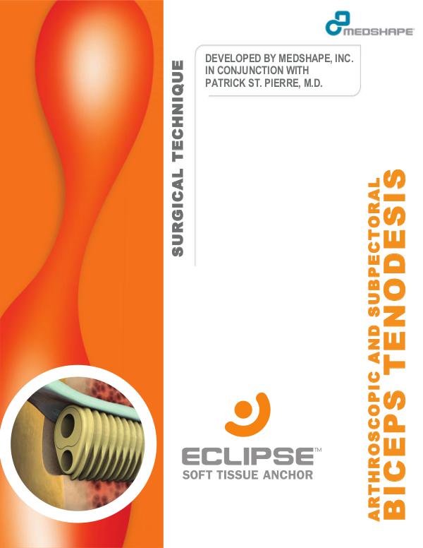 Biceps Tenodesis - Surgical Technique Guide | Eclipse™ Soft Tissue An Biceps Tenodesis - Surgical Technique Guide  Eclip