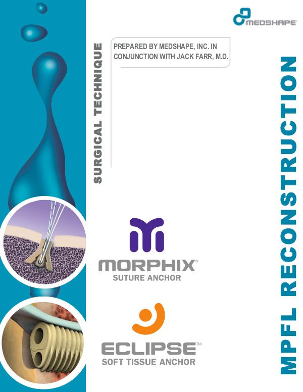 MPFL Reconstruction - Surgical Technique Guide | MedShape MPFL Reconstruction - Surgical Technique Guide  Me