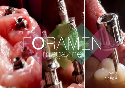 FORAMEN dental magazine 1. Cirurgia